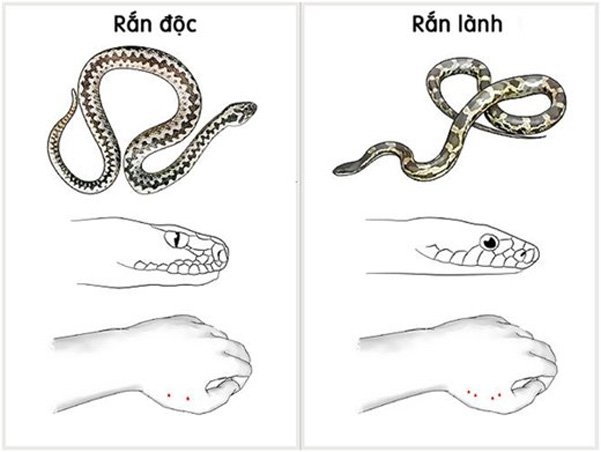 Cách xử lý khi bị rắn cắn